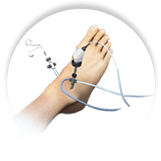 Arthroscopic Ankle Surgery